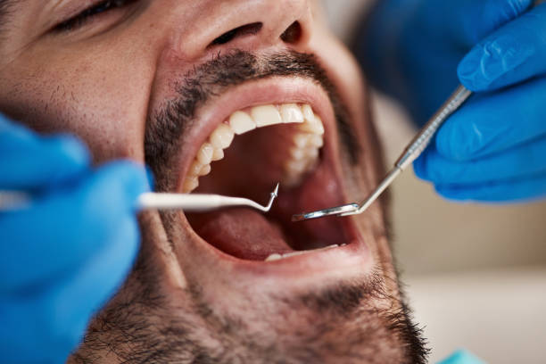 Best Root Canal Treatment  in Magee, MS